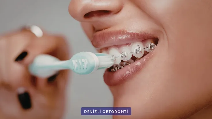 Braketli dişlerin elektrikli diş fırçasıyla fırçalanması