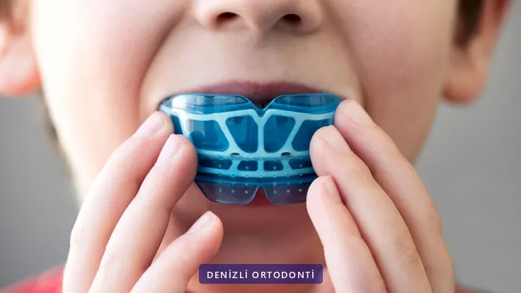 Mavi myofonksiyonel apareyini ağzına götüren çocuk